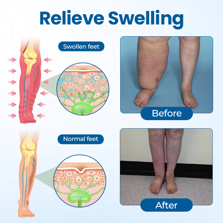 Timilk® Lymphora Swelling Relief Roll-On.