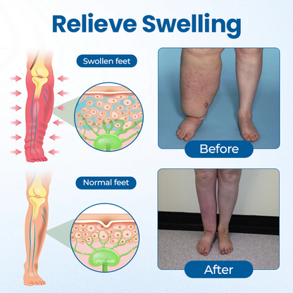 Timilk® Lymphora Swelling Relief Roll-On.