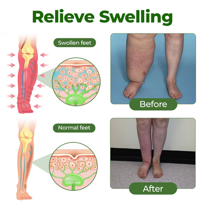 Timilk®Professional Leg Circulation Cream