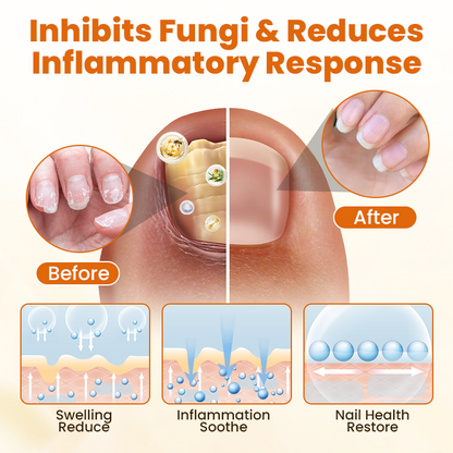 Timilk®  FungiBee Advanced Nail Repair Spray.