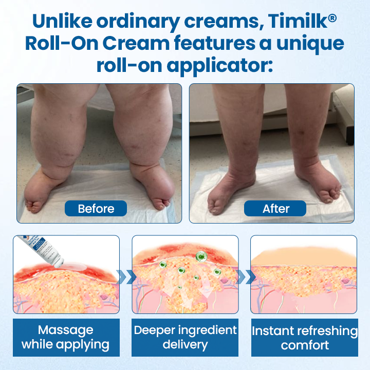 Timilk® Lymphora Swelling Relief Roll-On.