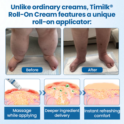 Timilk® Lymphora Swelling Relief Roll-On.