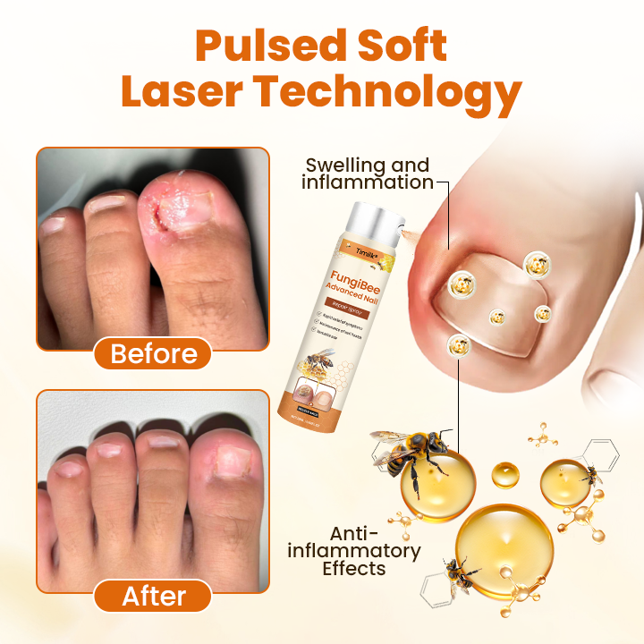 Timilk®  FungiBee Advanced Nail Repair Spray.