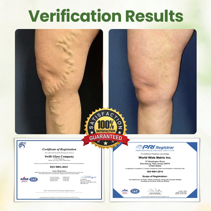 Biancat®  Lymphatic Detox Herbal Cream.