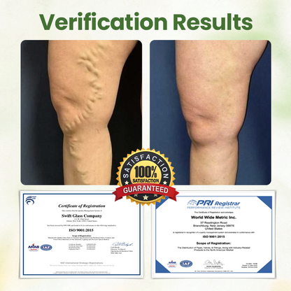 Biancat®  Lymphatic Detox Herbal Cream.