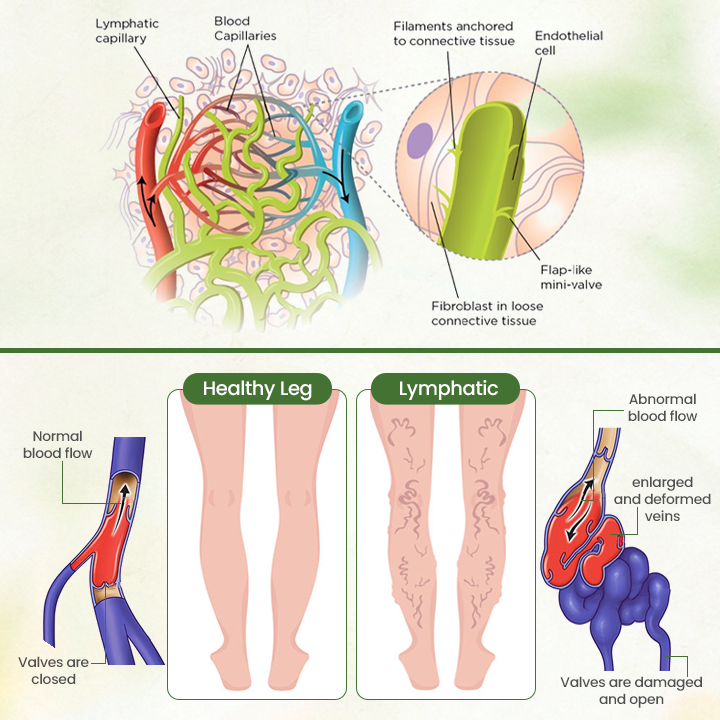 Biancat®  Lymphatic Detox Herbal Cream.
